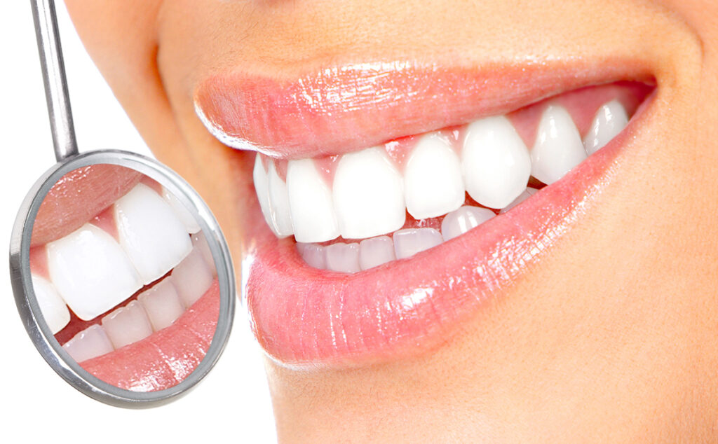 10 Tips on Taking Care of Teeth After Professional Teeth Whitening
