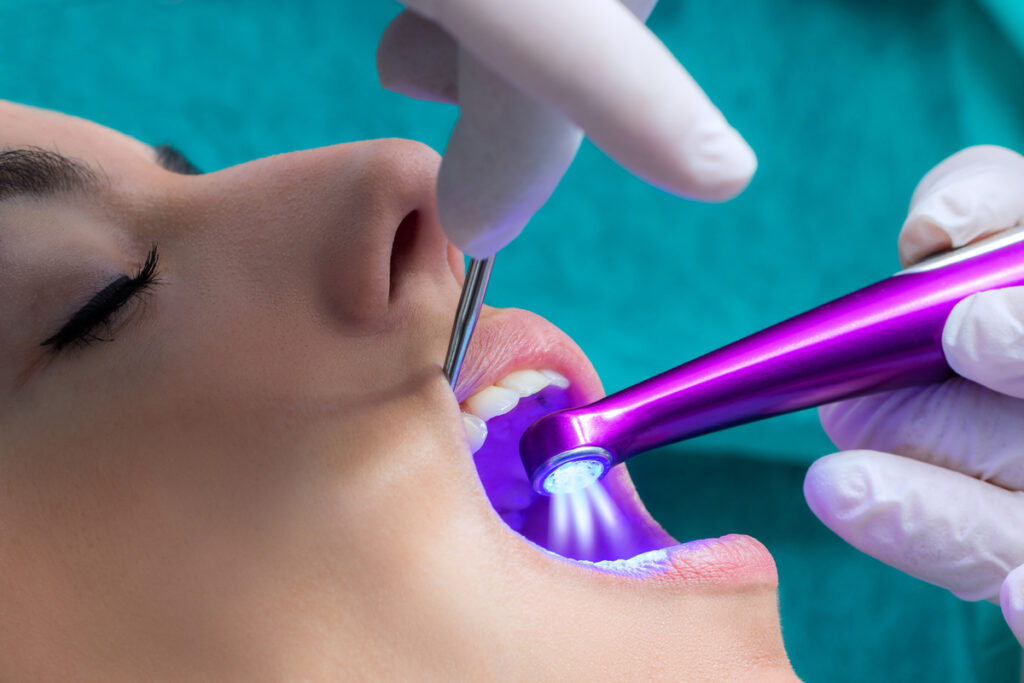 dental sealants, best dentist glendale AZ