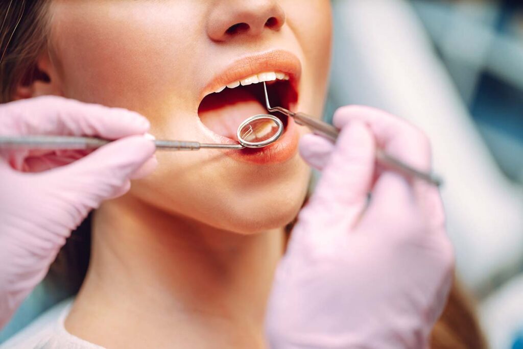 How Often Do You Need a Dental Cleaning?