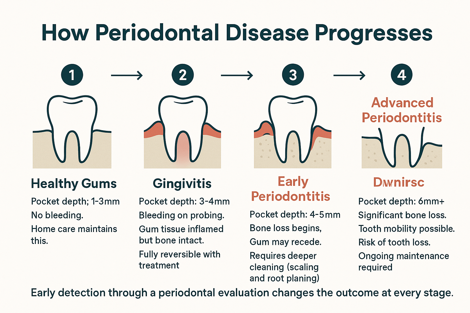 When Was the Last Time You Had a Periodontal Evaluation?