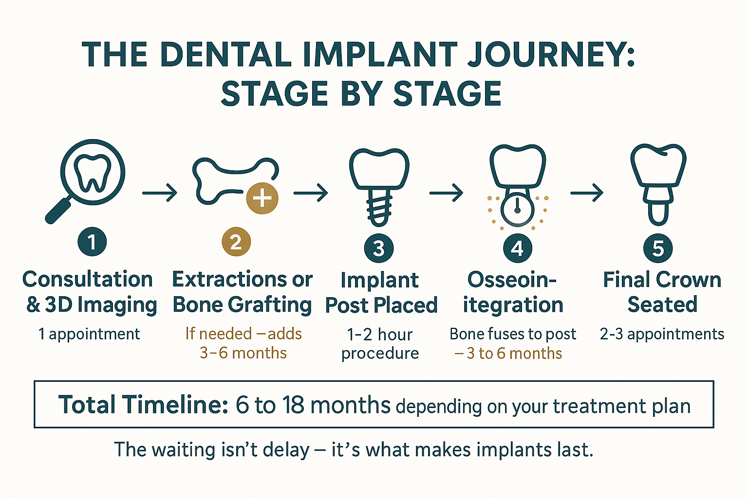 How Long Do Dental Implants Really Take From Start to Finish?